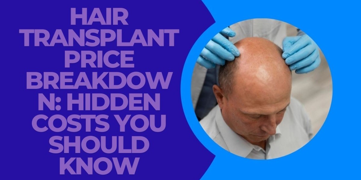 Hair Transplant Price Breakdown: Hidden Costs You Should Know